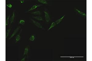 Immunofluorescence of purified MaxPab antibody to TIMM44 on HeLa cell. (TIMM44 antibody  (AA 1-452))