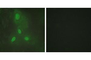Peptide - +Western blot analysis of extracts from HeLa cells, HepG2 cells and 293 cells, using BACH1 antibody. (BACH1 antibody)