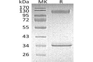 Western Blotting (WB) image for Selectin P (Granule Membrane Protein 140kDa, Antigen CD62) (SELP) protein (Fc Tag) (ABIN7320781) (P-Selectin Protein (Fc Tag))