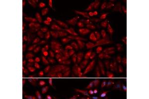 Immunofluorescence analysis of U2OS cells using NR1I3 Polyclonal Antibody (NR1I3 antibody)