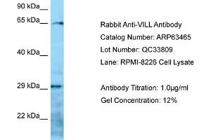 Western Blotting (WB) image for anti-Villin-Like (VILL) (N-Term) antibody (ABIN2789509) (VILL antibody  (N-Term))
