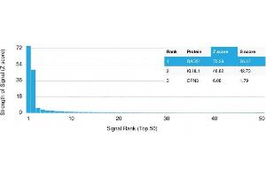 Analysis of Protein Array containing more than 19,000 full-length human proteins using RAD51 Mouse Monoclonal Antibody (RAD51/2701) Z- and S- Score: The Z-score represents the strength of a signal that a monoclonal antibody (MAb) (in combination with a fluorescently-tagged anti-IgG secondary antibody) produces when binding to a particular protein on the HuProtTM array. (RAD51 antibody  (AA 1-134))