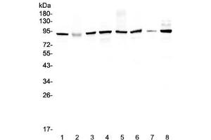 Western blot testing of human 1) HeLa 2) placenta, 3) MCF7, 4) A549, 5) SK-OV-3, 6) 22RV1, 7) A431 and 8) COLO320 lysate with UBA2 antibody at 0. (UBA2 antibody)