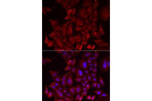 Immunofluorescence analysis of U2OS cells using PANX1 antibody (ABIN6290774).