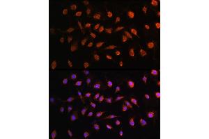 Immunofluorescence analysis of L929 cells using STK38 antibody (ABIN6132692, ABIN6148616, ABIN6148617 and ABIN6224215) at dilution of 1:100. (STK38 antibody  (AA 1-200))