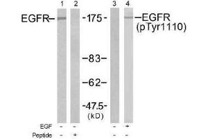Image no. 1 for anti-Epidermal Growth Factor Receptor (EGFR) (pTyr1110) antibody (ABIN197026) (EGFR antibody  (pTyr1110))