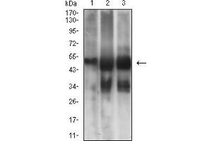 Western blot analysis using TUBB3 mouse mAb against NIH/3T3 (1), Hela (2), and A549 (3) cell lysate. (TUBB3 antibody)