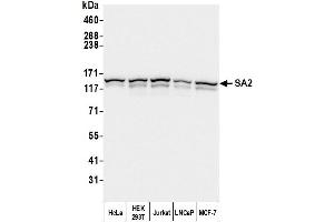 anti-Stromal Antigen 2 (STAG2) (AA 1125-1175) antibody