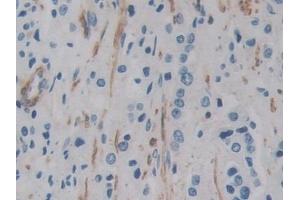 Immunohistochemistry (IHC) image for anti-Actin, gamma 2, Smooth Muscle, Enteric (ACTG2) (AA 3-376) antibody (ABIN7440569)