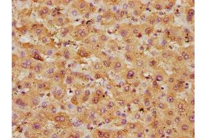 IHC image of ABIN7144729 diluted at 1:250 and staining in paraffin-embedded human liver tissue performed on a Leica BondTM system.