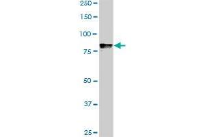 DYRK1A monoclonal antibody (M01), clone 7D10. (DYRK1A antibody  (AA 674-763))