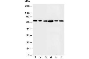 Western blot testing of FAF1 antibody and Lane 1:  rat testis;  2: MM453;  3: MM231;  4: HeLa;  5: SMMC-7721;  6: SW620 (FAF1 antibody  (N-Term))