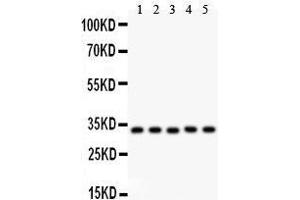 Anti- HMOX1 antibody, Western blotting All lanes: Anti HMOX1  at 0. (HMOX1 antibody  (AA 1-288))
