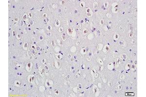 Formalin-fixed and paraffin embedded rat brain labeled with Anti-Phospho-Dab1 (Tyr232) Polyclonal Antibody, Unconjugated (ABIN684343) at 1:200 followed by conjugation to the secondary antibody and DAB staining (DAB1 antibody  (pTyr232))