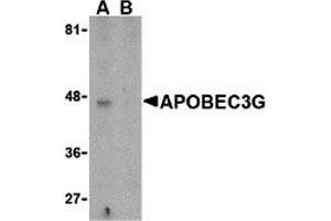 Western Blotting (WB) image for anti-Apolipoprotein B mRNA Editing Enzyme, Catalytic Polypeptide-Like 3G (APOBEC3G) (N-Term) antibody (ABIN1031236) (APOBEC3G antibody  (N-Term))