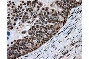 Immunohistochemical staining of paraffin-embedded colon tissue using anti-MTRF1L mouse monoclonal antibody. (MTRF1L antibody)
