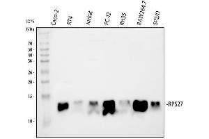 anti-Ribosomal Protein S27 (RPS27) (AA 2-84) antibody