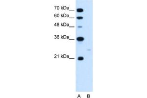 Western Blotting (WB) image for anti-MAX Interactor 1 (MXI1) antibody (ABIN2460213)