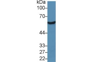 Western blot analysis of Rat Liver lysate, using Human ALDH7A1 Antibody (5 µg/ml) and HRP-conjugated Goat Anti-Rabbit antibody ( (ALDH7A1 antibody  (AA 1-539))