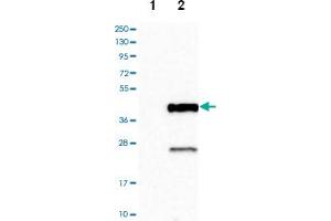 Western blot analysis of Lane 1: Negative control (vector only transfected HEK293T lysate), Lane 2: Over-expression lysate (Co-expressed with a C-terminal myc-DDK tag (~3. (Cathepsin S antibody)