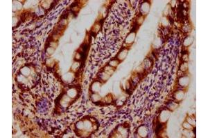 Immunohistochemical of paraffin-embedded human small intestinal tissue using ABIN7153439 at dilution of 1:100 (Galectin 3 antibody)
