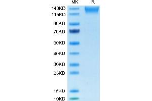 SEZ6L2 Protein (AA 28-844) (His tag)