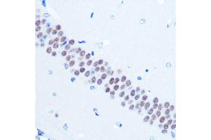 Immunohistochemistry of paraffin-embedded mouse brain using TLE1 Rabbit mAb (ABIN7270903) at dilution of 1:100 (40x lens). (TLE1 antibody)