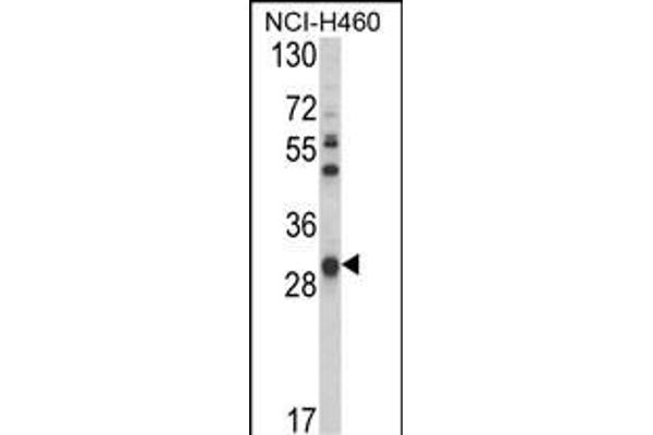 GSTO1 antibody  (AA 126-155)