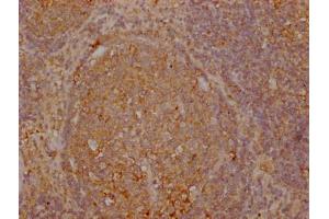 Immunohistochemistry (IHC) image for anti-Tumor Necrosis Factor Receptor Superfamily, Member 17 (TNFRSF17) (AA 1-54) antibody (ABIN7172255)