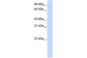 WB Suggested Anti-ERCC8 Antibody Titration: 0. (ERCC8 antibody  (Middle Region))