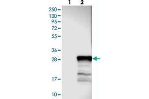Western blot analysis of Lane 1: Negative control (vector only transfected HEK293T lysate), Lane 2: Over-expression Lysate (Co-expressed with a C-terminal myc-DDK tag (~3. (TEX33 antibody)