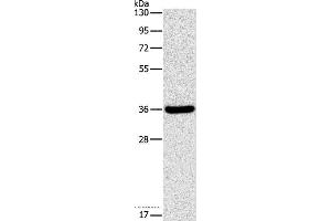 Western blot analysis of Human fetal liver tissue, using FGL1 Polyclonal Antibody at dilution of 1:1050