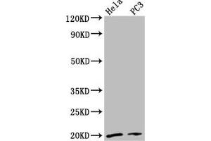 Western Blot Positive WB detected in: Hela whole cell lysate, PC-3 whole cell lysate All lanes: NDUFAF2 antibody at 2. (NDUFAF2 antibody  (AA 117-169))