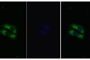 Detection of IL22R in Human HepG2 cell using Polyclonal Antibody to Interleukin 22 Receptor (IL22R) (IL22R antibody  (AA 267-565))