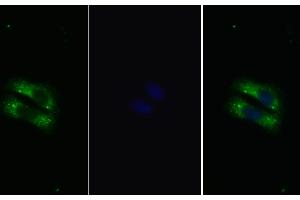 Detection of IL22R in Human HepG2 cell using Polyclonal Antibody to Interleukin 22 Receptor (IL22R)