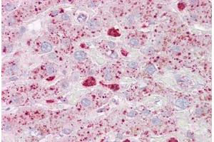 Anti-USP15 antibody IHC staining of human liver. (USP15 antibody  (AA 970-981))