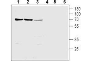 Western blot analysis of rat kidney (lanes 1 and 4), rat liver (lanes 2 and 5) and mouse kidney (lanes 3 and 6) lysates: - 1-3. (SLC28A1 antibody  (Intracellular, N-Term))