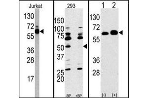Image no. 1 for anti-Ribosomal Protein S6 Kinase, 70kDa, Polypeptide 1 (RPS6KB1) (Middle Region) antibody (ABIN358256)