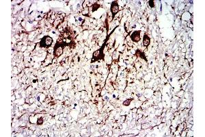 Immunohistochemical analysis of paraffin-embedded medulla oblongata tissues using TUBA8 mouse mAb with DAB staining.