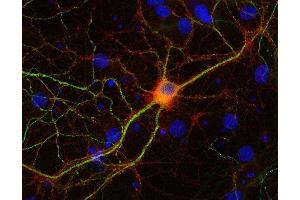 Indirect immunostaining of PFA fixed rat hippocampus neurons with anti-NSF (dilution 1 : 500; red) and mouse anti-MAP 2 (, dilution 1 : 1000; green). (NSF antibody  (AA 733-744))