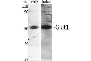 anti-Solute Carrier Family 2 (Facilitated Glucose Transporter), Member 1 (SLC2A1) (AA 410-490) antibody