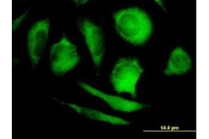 Immunofluorescence of purified MaxPab antibody to PPP5C on HeLa cell. (PP5 antibody  (AA 1-499))