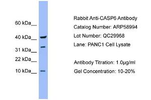 WB Suggested Anti-CASP6  Antibody Titration: 0. (Caspase 6 antibody  (Middle Region))