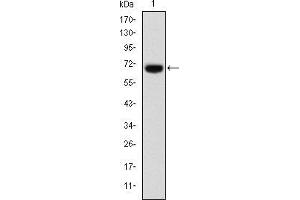 Western blot analysis using FOXP2 mAb against human FOXP2 (AA: 47-287) recombinant protein. (FOXP2 antibody)
