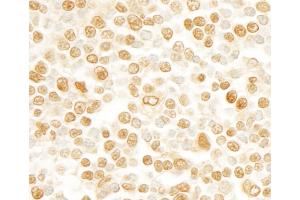 anti-SR-Related CTD-Associated Factor 11 (SCAF11) (C-Term) antibody