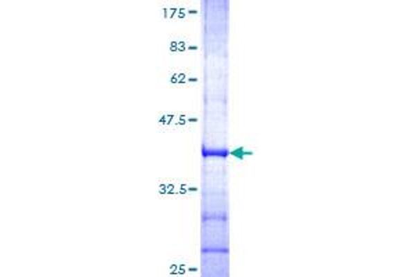 Glutamate Receptor 1 Protein (GLUR1) (AA 201-300) (GST tag)