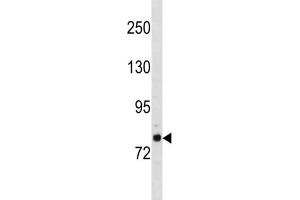 Western Blotting (WB) image for anti-Golgin A6 Family-Like 2 (GOLGA6L2) antibody (ABIN3004545) (GOLGA6L2 antibody)