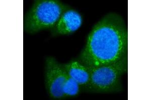 anti-Protein O-Glucosyltransferase 1 (POGLUT1) (C-Term) antibody