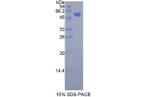 SDS-PAGE analysis of Human NSMASE Protein. (SMPD2 Protein)