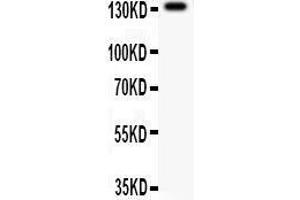 Anti- NMDAR2C Picoband antibody, Western blotting All lanes: Anti NMDAR2C  at 0. (GRIN2C antibody  (AA 43-242))